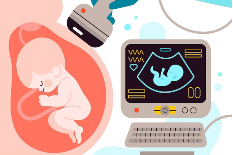 Monitorização do bem-estar fetal