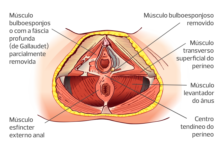 Períneo e diafragma urogenital feminino