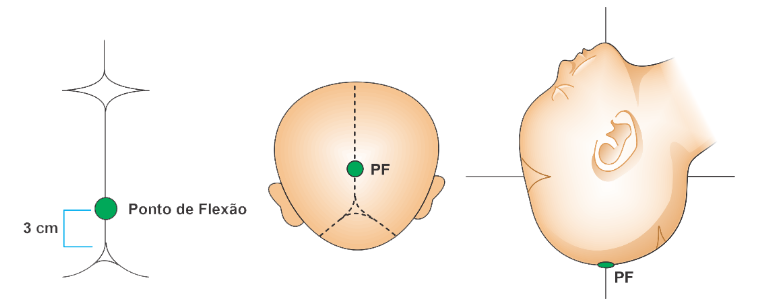 Ponto de flexão do polo cefálico fetal