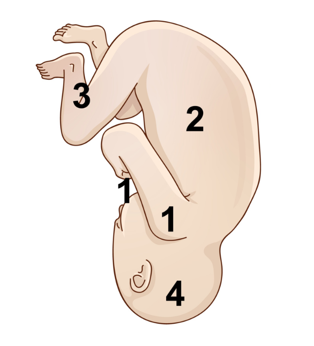 Manobra de Patwardhan – “ombro primeiro” com dorso anterior